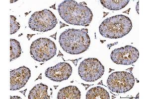 IHC analysis of AHA1/AHSA1 using anti-AHA1/AHSA1 antibody (ABIN7600708). (AHSA1 anticorps  (AA 221-264))