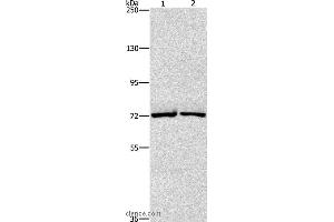 Western blot analysis of Hela and hepG2 cell, using CEL Polyclonal Antibody at dilution of 1:550