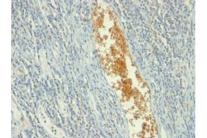 Formalin-fixed, paraffin-embedded human Tonsil stained with AMPD3 Mouse Monoclonal Antibody (AMPD3/901) (AMPD3 anticorps)
