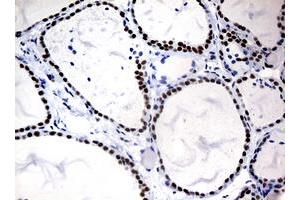 Image no. 4 for anti-Nibrin (NBN) (AA 461-754) antibody (ABIN1491540)