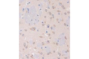 Immunohistochemistry of paraffin-embedded Mouse brain using STIM2 Rabbit pAb (ABIN7270611) at dilution of 1:100 (40x lens).