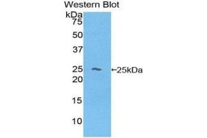 Western Blotting (WB) image for anti-Hemoglobin beta (HBB) (AA 1-145) antibody (ABIN1175990) (Hemoglobin Subunit beta anticorps  (AA 1-145))