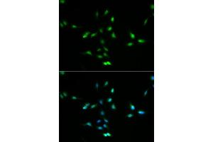 Immunofluorescence analysis of A549 cell using MDM2 antibody.