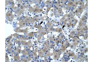 KIF5B antibody was used for immunohistochemistry at a concentration of 4-8 ug/ml to stain Hepatocytes (arrows) in Human Liver.