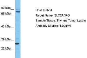 Host: Rabbit Target Name: SLC2A4RG Sample Type: Thymus Tumor lysates Antibody Dilution: 1.