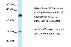 WB Suggested Anti-HSF2 Antibody   Titration: 1. (HSF2 anticorps  (N-Term))