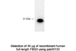 Image no. 1 for anti-F-Box Protein 44 (FBXO44) (C-Term) antibody (ABIN363442) (FBXO44 anticorps  (C-Term))