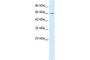 WB Suggested Anti-MYEF2 Antibody Titration:  0. (MYEF2 anticorps  (Middle Region))