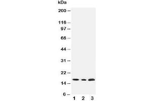 Western blot testing of SDHC antibody and Lane 1:  rat liver;  2: HeLa;  3: Jurkat cell lysate (SDHC anticorps  (N-Term))