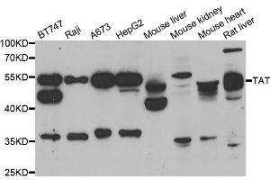 Western blot analysis of extracts of various cell lines, using TAT antibody.