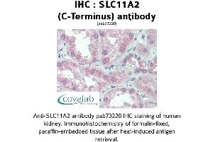 Image no. 2 for anti-Solute Carrier Family 11 (Proton-Coupled Divalent Metal Ion Transporters), Member 2 (SLC11A2) (C-Term) antibody (ABIN1739322)