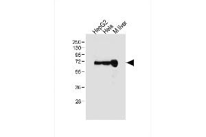 All lanes : Anti-ALB Antibody (C-term) at 1:1000 dilution Lane 1: HepG2 whole cell lysate Lane 2: Hela whole cell lysate Lane 3: Mouse liver tissue lysate Lysates/proteins at 20 μg per lane. (Albumin anticorps  (C-Term))