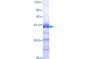 Image no. 1 for Topoisomerase (DNA) II beta 180kDa (TOP2B) (AA 1411-1523) protein (GST tag) (ABIN1323349)
