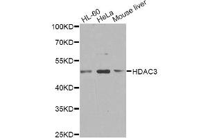 Western blot analysis of extracts of various cell lines, using HDAC3 antibody. (HDAC3 anticorps)