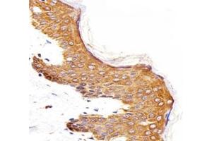 IHC analysis of FFPE human skin section using Epidermal Growth Factor Receptor antibody (EGFR anticorps  (AA 259-287))