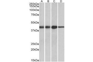 Western blot analysis: ACAT1 antibody staining of Mouse (A) and Rat (B) kidney lysates, and Mouse (C) and Rat (D) Liver lysates at 0. (ACAT1 anticorps  (Internal Region))