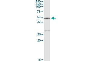 Immunoprecipitation of CPA1 transfected lysate using mouse monoclonal anti-CPA1 and Protein A Magnetic Bead