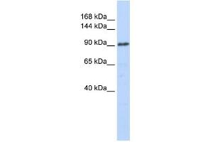 WB Suggested Anti-GTF3C3 Antibody Titration:  0. (GTF3C3 anticorps  (N-Term))