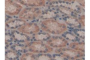 Detection of GAL8 in Human Kidney Tissue using Polyclonal Antibody to Galectin 8 (GAL8)