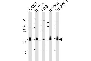All lanes : Anti-CD59 Antibody (Center) at 1:2000 dilution Lane 1: HUVEC whole cell lysate Lane 2: BxPC-3 whole cell lysate Lane 3: PC-3 whole cell lysate Lane 4: Human breast lysate Lane 5: Human placenta lysate Lysates/proteins at 20 μg per lane. (CD59 anticorps  (AA 74-110))