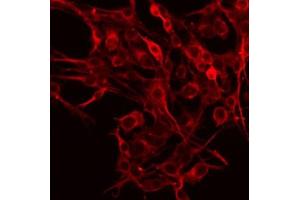 ABIN6266860 staining HeLa by IF/ICC. (Ephrin A5 anticorps  (Internal Region))