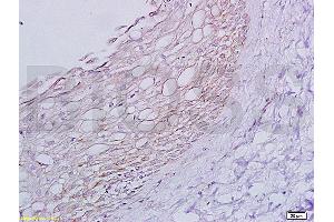 Formalin-fixed paraffin embedded rat ovary tissue labeled with Anti-ADRB1 Polyclonal Antibody, Unconjugated (ABIN669351) at 1:200 followed by conjugation to the secondary antibody and DAB staining