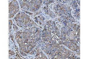 IHC analysis of TRMT61B using anti-TRMT61B antibody (ABIN7602334). (TRMT61B anticorps  (AA 7-477))