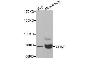 Western blot analysis of extracts of various cell lines, using CHAT antibody. (Choline Acetyltransferase anticorps  (AA 331-630))