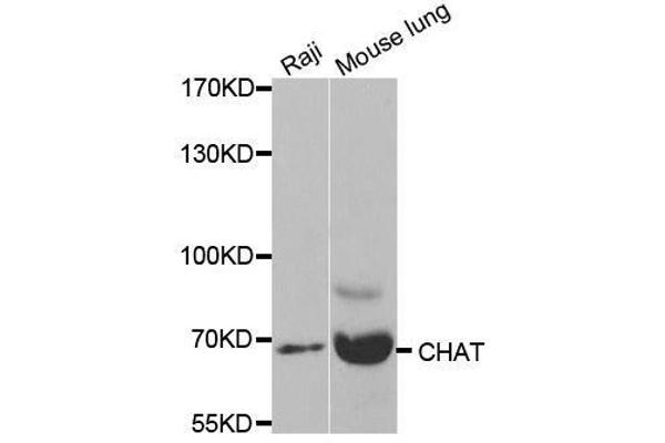 Choline Acetyltransferase 抗体  (AA 331-630)
