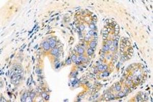 Immunohistochemistry analysis of paraffin-embedded rat rectum using,FAM135B (ABIN7073910) at dilution of 1: 1000 (FAM135B anticorps)