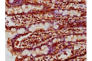 IHC image of ABIN7150177 diluted at 1:10 and staining in paraffin-embedded human small intestine tissue performed on a Leica BondTM system.