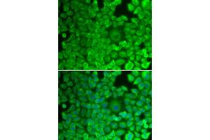 Immunofluorescence (IF) image for anti-Glycogen Synthase 1 (Muscle) (GYS1) antibody (ABIN1872925) (Glycogen Synthase 1 anticorps)