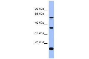 LARP6 antibody used at 1 ug/ml to detect target protein. (LARP6 anticorps  (Middle Region))