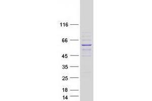 Validation with Western Blot