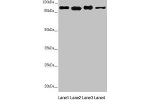 Western blot All lanes: DHTKD1 antibody at 1. (DHTKD1 anticorps  (AA 1-280))