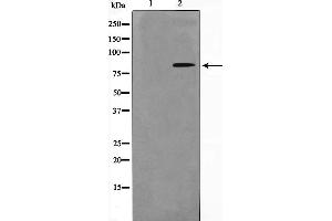 Western blot analysis on HuvEc cell lysate using Phospho-Nibrin(Ser278) Antibody，The lane on the left is treated with the antigen-specific peptide. (Nibrin anticorps  (pSer278))