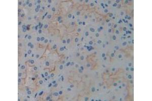 Figure. (ICAM1 anticorps  (AA 41-464))