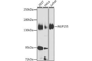 Western blot analysis of extracts of various cell lines, using NUP155 Antibody (ABIN6128363, ABIN6144953, ABIN6144954 and ABIN6223714) at 1:1000 dilution. (NUP155 anticorps  (AA 1102-1391))
