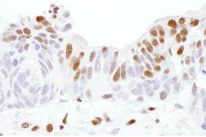 Immunohistochemistry (IHC) image for anti-Sp1 Transcription Factor (SP1) (AA 735-785) antibody (ABIN7453450)