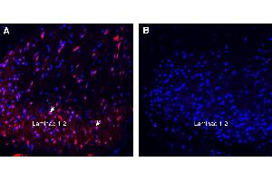 Expression of TRPA1 in rat spinal cord.