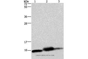 Western blot analysis of Mouse heart, human fetal liver and hepatocellular carcinoma tissue,, using COX6B1 Polyclonal Antibody at dilution of 1:1150 (COX6B1 anticorps)