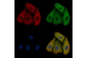 TUSC1 Mouse Monoclonal Antibody staining Hela cells by IF/ICC. (TUSC1 anticorps)
