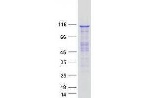 Validation with Western Blot