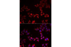 Immunofluorescence analysis of A549 cells using LIMS1 antibody (ABIN6293172). (LIMS1 anticorps)