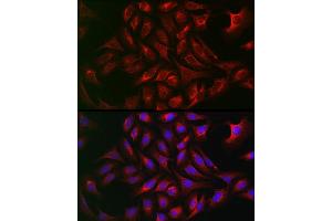 Immunofluorescence analysis of U2OS cells using  Rabbit pAb (ABIN7265789) at dilution of 1:50 (40x lens). (ATG12 anticorps  (AA 1-74))