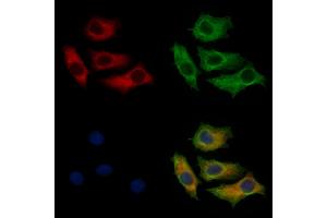 ABIN7093853 and ABIN7097896 staining HepG2 cells by IF/ICC. (CTPS2 anticorps  (C-Term))