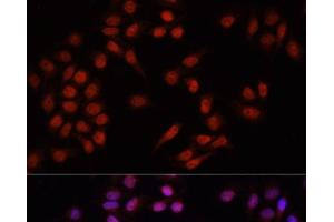 Immunofluorescence analysis of HeLa cells using PRDM14 Polyclonal Antibody at dilution of 1:100. (PRDM14 anticorps)