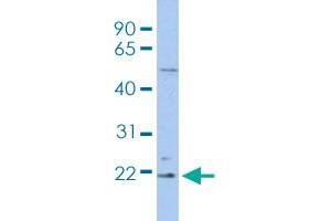 Western blot analysis of THP-1 cell lysate with RBBP9 polyclonal antibody . (RBBP9 anticorps  (AA 1-50))