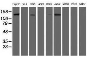 Image no. 2 for anti-Histone Deacetylase 6 (HDAC6) antibody (ABIN1498618)