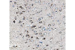 IHC analysis of MEK2/MAP2K2 using anti-MEK2/MAP2K2 antibody (ABIN7599357).